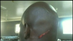 Denuncian más golpizas a cubanos en Bahamas